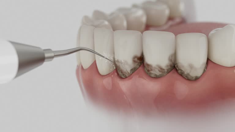 Reliable Dental Implants contractor in Stamps, AR by Smile Center Dentistry